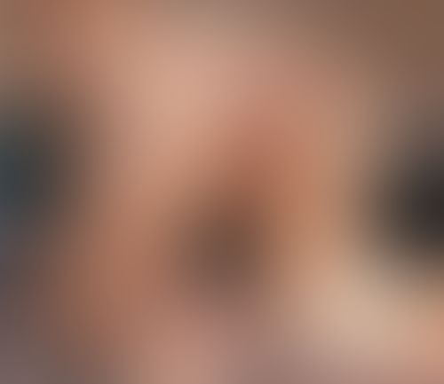 Imagem 1 de 1 - null}