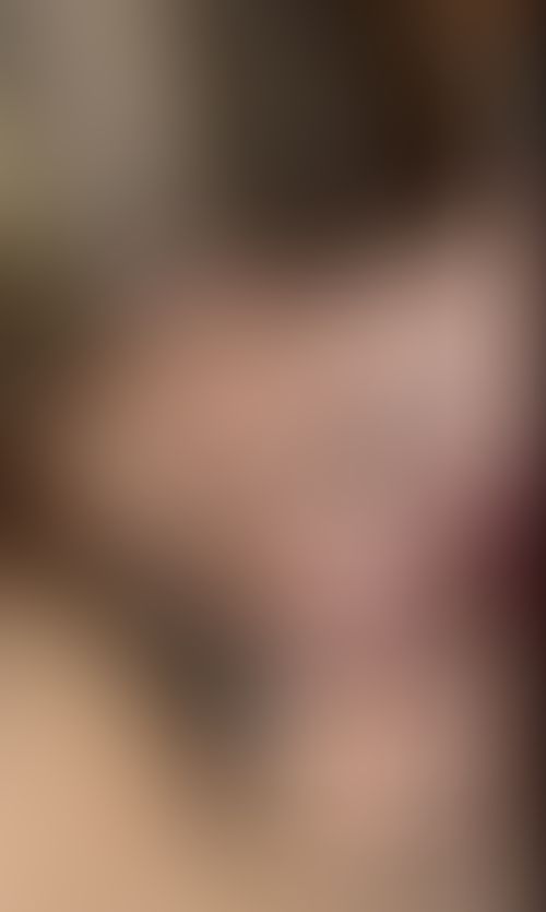 Imagem 2 de 2 - null}