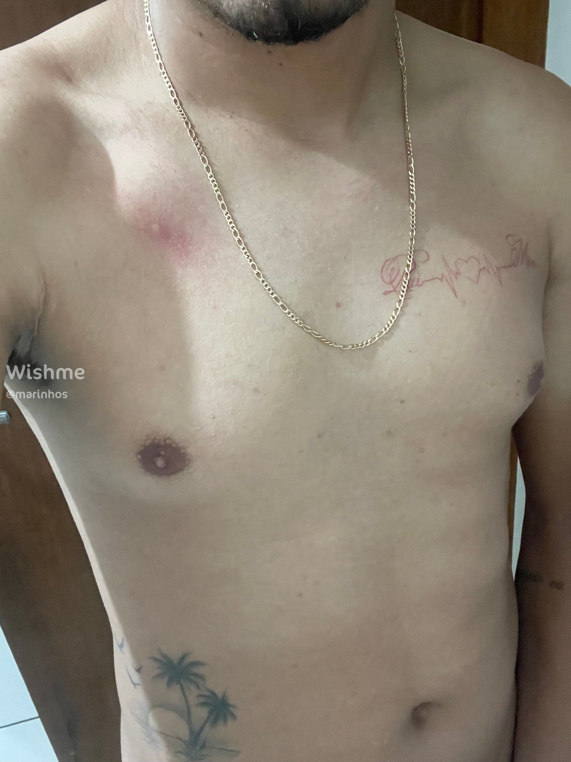 Imagem 1 de 1 - null}